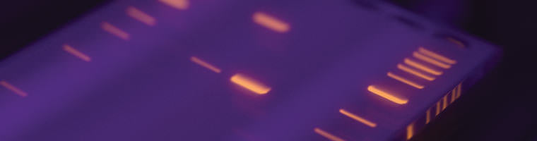 NEB_dnaleitern_Header_760px DNA Leitern Header